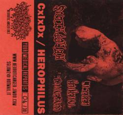 Congenital Interior Defect - Herophilus